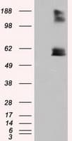LIPG / Endothelial Lipase Antibody (clone OTI7D1)