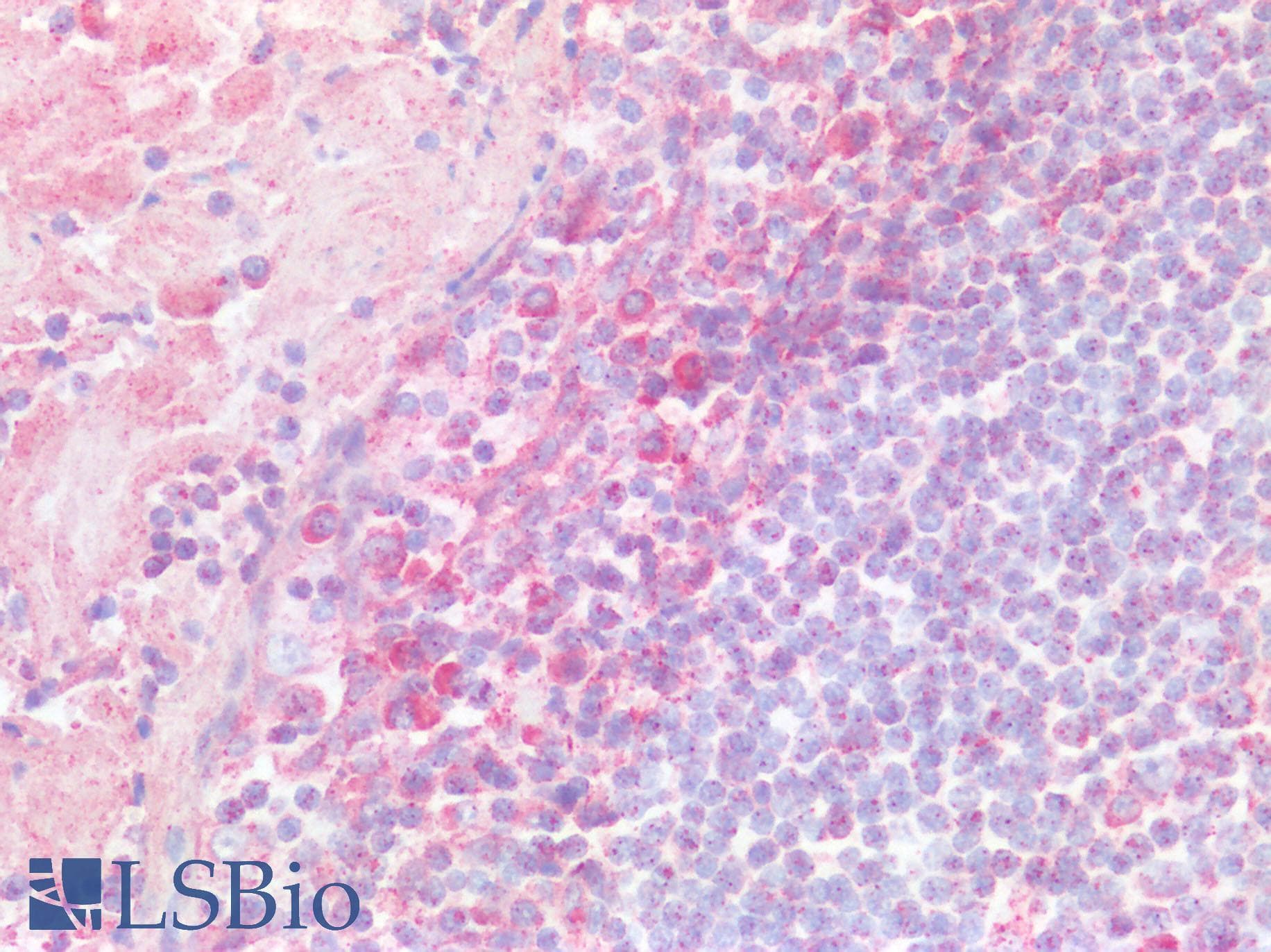 GCN2 Antibody (aa1-300)