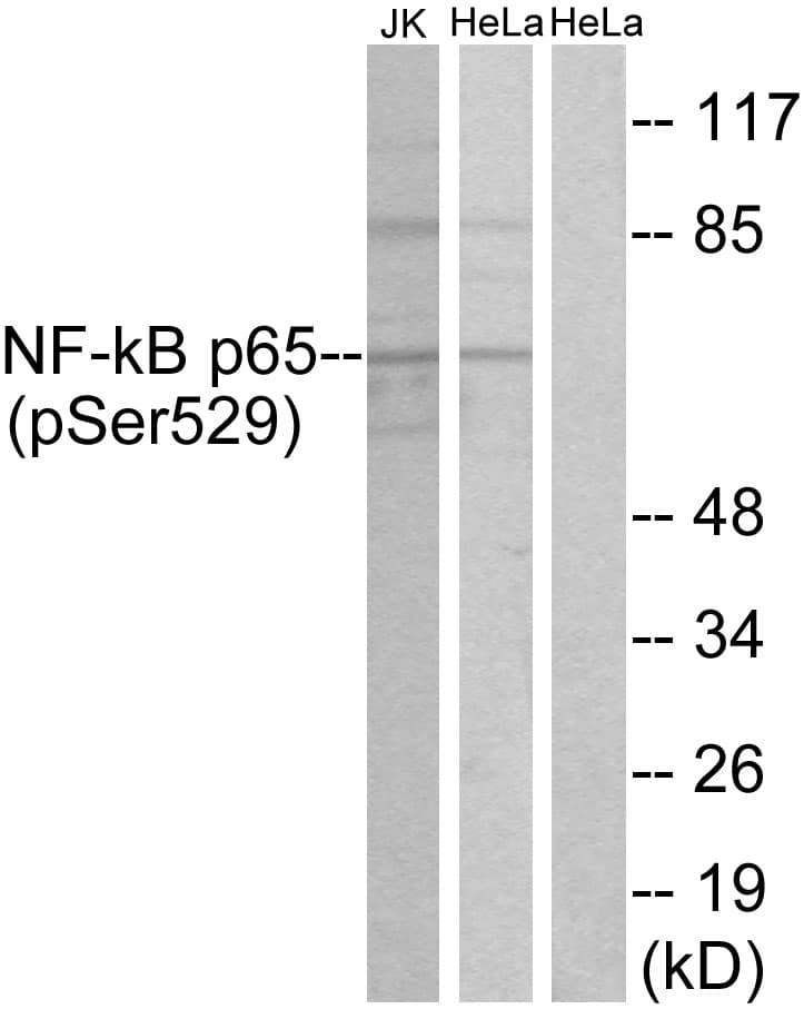 Polyclonal Rabbit anti-Human RELA / NFKB p65 Antibody (phospho-Ser529, IHC, WB)