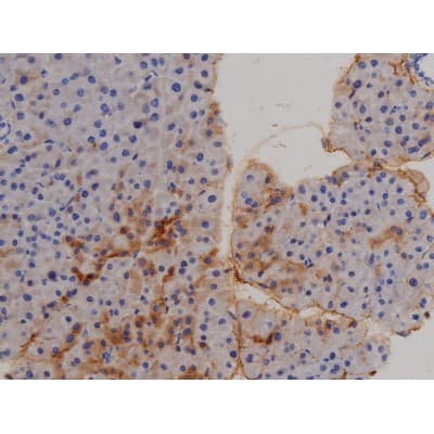 STAT6 Antibody (phospho-Tyr641)