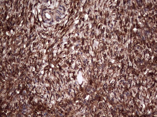 LGALS3 / Galectin 3 Antibody (clone OTI7G9, Carrier-free)