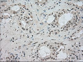 BUB1B / BubR1 Antibody (clone OTI5D9)