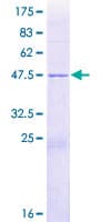Human NOLA2 Protein (Recombinant GST)