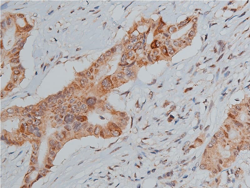 TP53 / p53 Antibody (phospho-Ser20)