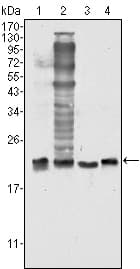 SOD1 / Cu-Zn SOD Antibody (clone 6F5)