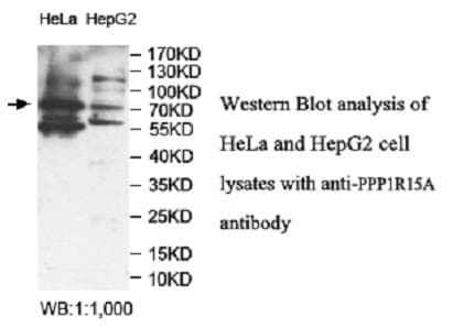 PPP1R15A / GADD34 Antibody (aa115-211)