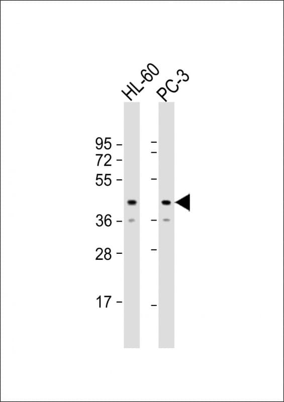 Polyclonal Rabbit anti-Human MRI1 Antibody (Internal, WB)