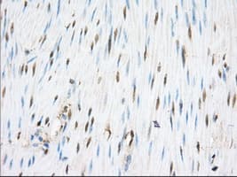 Monoclonal Mouse anti-Human PDE4A / PDE4 Antibody (clone OTI6D6, IHC, IF, WB)