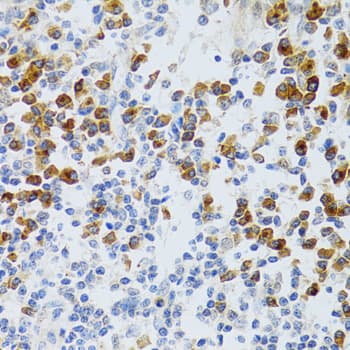 CHAF1B / CAF1 Antibody