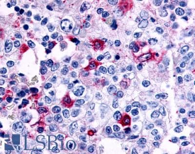 PathPlus™ CCR8 / CD198 Antibody (C-Terminus)