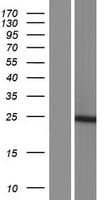 AK6 / Adenylate Kinase 6 Protein (Over-Expression Lysate Myc-DDK (Flag))