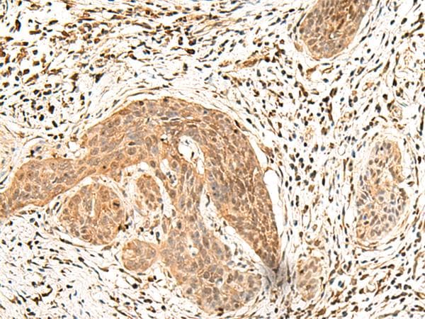 LDHA / LDH1 Antibody