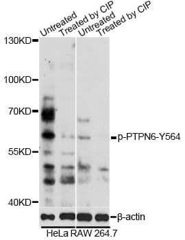 PTPN6 / SHP1 Antibody (phospho-Tyr564)