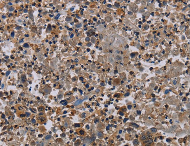 IHC-plus™ Polyclonal Rabbit anti-Human PVRL4 / Nectin 4 Antibody (aa371-510, IHC, WB)