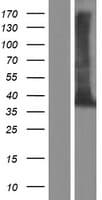 TEX264 Protein (Over-Expression Lysate Myc-DDK (Flag))