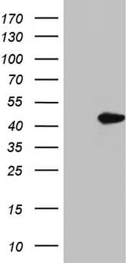 MEOX1 Antibody (clone OTI2A6)