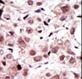 AXL Antibody (aa13-44)