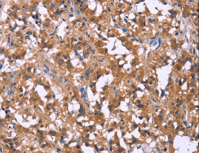 SLC52A1 / GPR172B / PAR2 Antibody