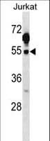 c-Src Kinase / CSK Antibody (aa377-404)