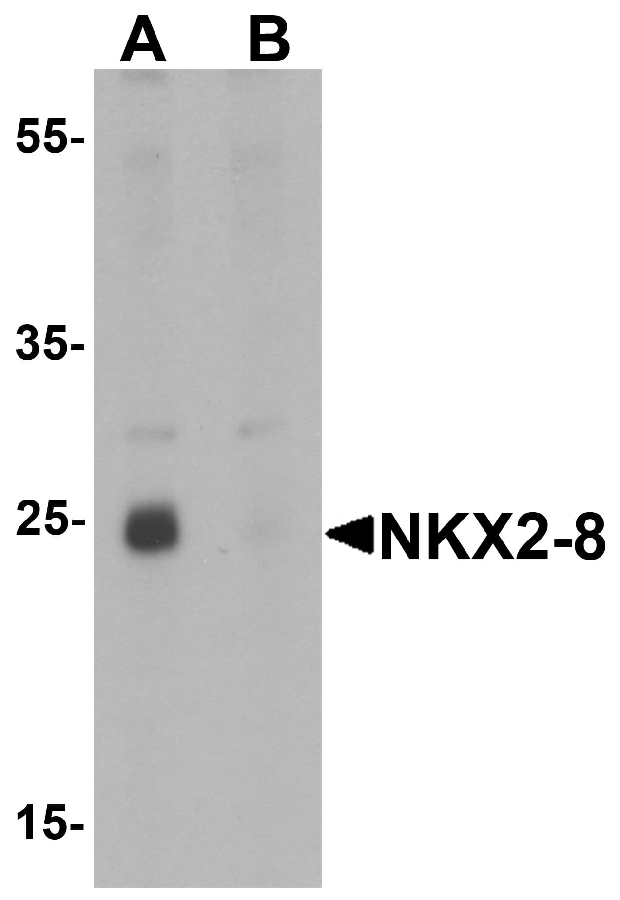 NKX2-6 Antibody
