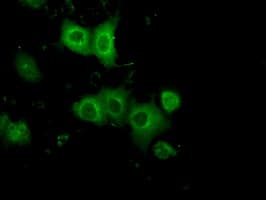 PRKAR2A Antibody (clone OTI4A3)