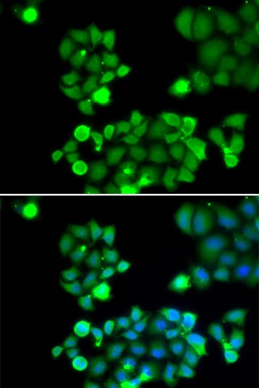 NEIL1 Antibody
