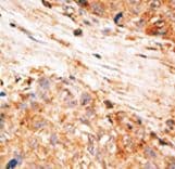 BIRC7 / Livin Antibody (aa271-298)