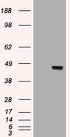 KRT19 / CK19 / Cytokeratin 19 Antibody (clone OTI5D1)