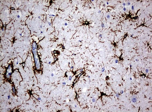 Monoclonal Mouse anti-Human GFAP Antibody (clone UMAB5, IHC, IF, WB)