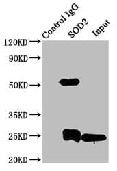 IHC-plus™ SOD2 / Mn SOD Antibody (aa64-175)