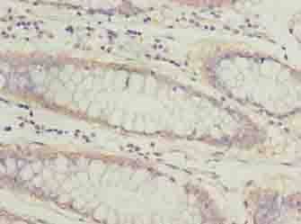 Polyclonal Rabbit anti-Human ATL2 Antibody (IHC, WB)