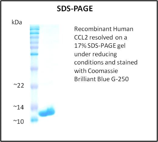 Human CCL2 / MCP1 Protein (Recombinant)