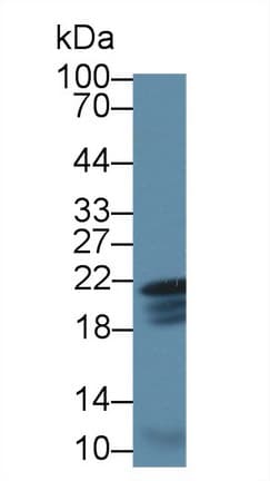 CAV1 / Caveolin 1 Antibody (aa2-105, Cy3)