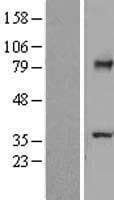 TCTN2 Protein (Over-Expression Lysate Myc-DDK (Flag))
