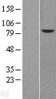 FZD6 / Frizzled 6 Protein (Over-Expression Lysate Myc-DDK (Flag))