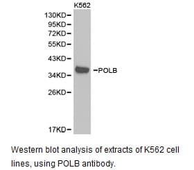 POLB / DNA Polymerase Beta Antibody