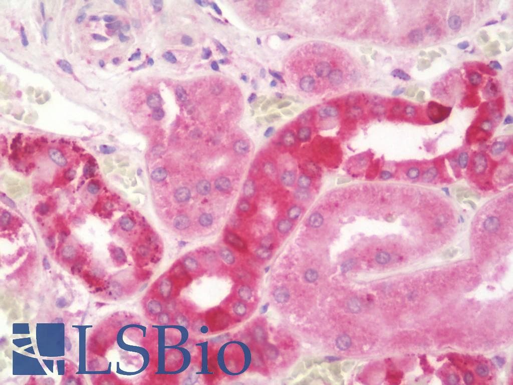 IHC-plus™ HSD2 / HSD11B2 Antibody (aa277-306)