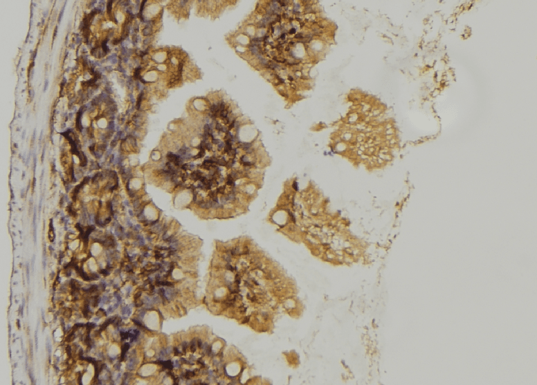 Polyclonal Rabbit anti-Human GPSM1 / AGS3 Antibody (IHC, WB)
