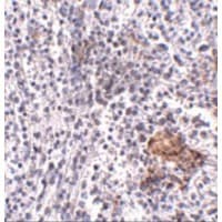 Polyclonal Rabbit anti-Human SHOC2 Antibody (IHC, WB)