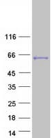 Human LEMD2 Protein (Recombinant Myc-DDK (Flag))