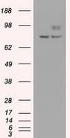 Monoclonal Mouse anti-Human PMEL / SILV / gp100 Antibody (clone OTI10E5, IHC, IF, WB)