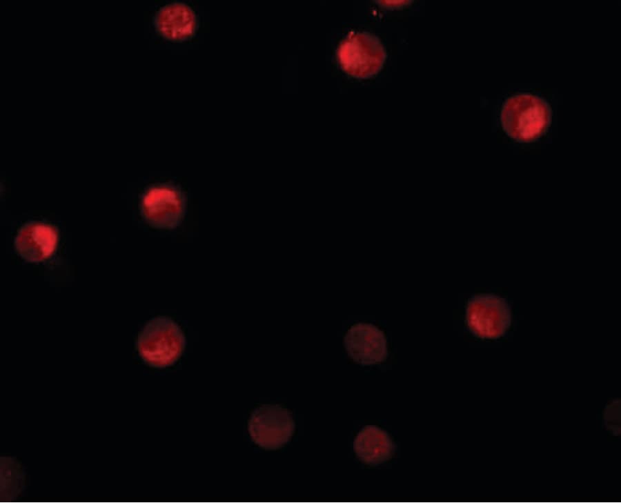 N4BP1 Antibody