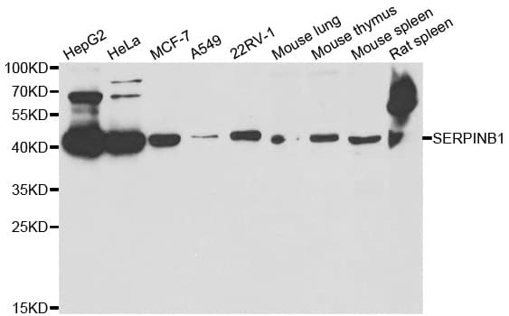 Polyclonal Rabbit anti-Human SERPINB1 Antibody (IHC, IF, WB)