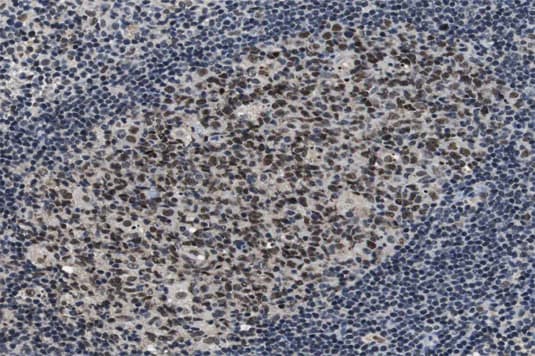 GSK3A / GSK3 Alpha Antibody (phospho-Ser21)