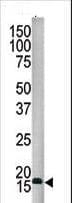 SUMO4 Antibody (Internal)