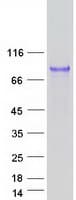 Human UMOD / Uromodulin Protein (Recombinant Myc-DDK (Flag))