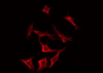 Polyclonal Rabbit anti-Human TRAIL-R4 / DCR2 Antibody (IF, WB)