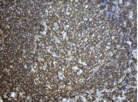 CD20 Antibody (clone OTI11F7, Carrier-free)