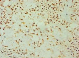 DKK4 Antibody (aa19-224)