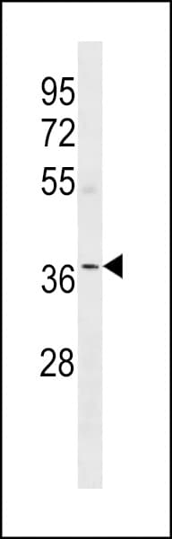 Polyclonal Rabbit anti-Human OR5W2 Antibody (aa276-303, WB)